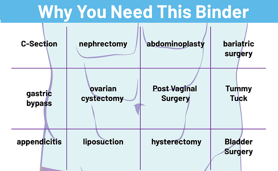 umbilical hernia belt