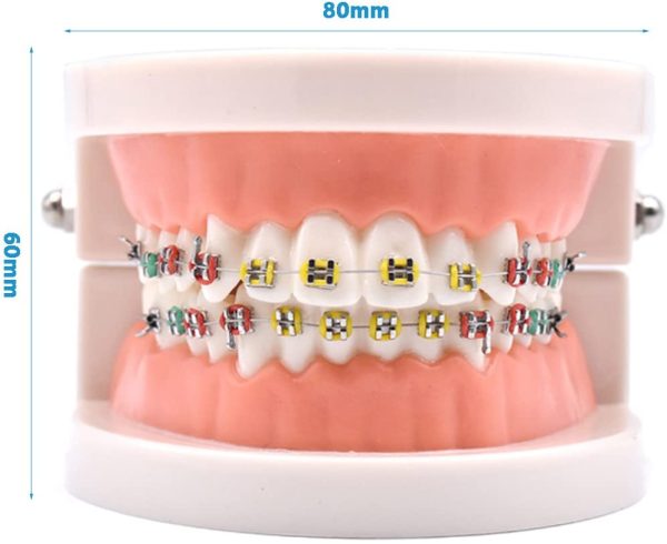 Angzhili Dental Orthodontic Treatment Teeth Model with Metal Bracket, Arch Wire Buccal Tube Ligature Ties Model with Braces for Teaching - Image 3