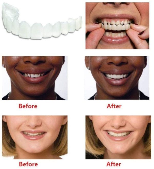 Braces Snap On Perfect Smile Instant Veneers Dentures Fake Teeth Smile Serrated Denture Teeth Top and Bottom Comfort Fit Flex Teeth Socket to Make White Tooth Beautiful Neat - Image 8