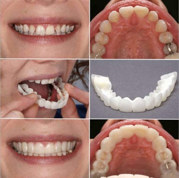 Braces Snap On Perfect Smile Instant Veneers Dentures Fake Teeth Smile Serrated Denture Teeth Top and Bottom Comfort Fit Flex Teeth Socket to Make White Tooth Beautiful Neat - Image 5