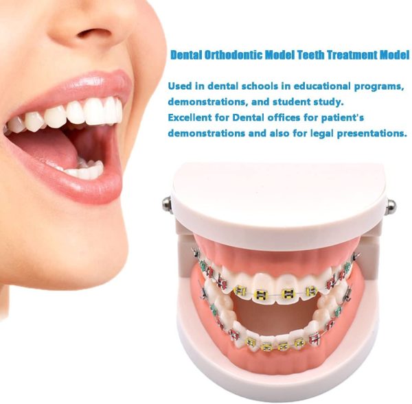 Angzhili Dental Orthodontic Treatment Teeth Model with Metal Bracket, Arch Wire Buccal Tube Ligature Ties Model with Braces for Teaching - Image 5