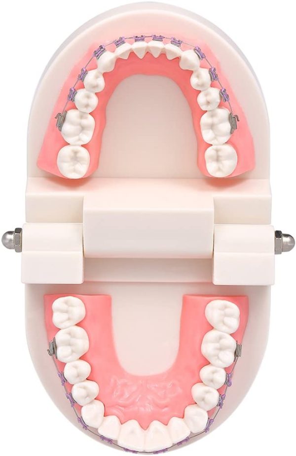 Angzhili Dental Orthodontic Treatment Teeth Model with Metal Bracket, Arch Wire Buccal Tube Ligature Ties Model with Braces for Teaching - Image 6