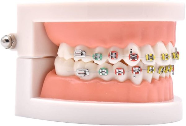 Angzhili Dental Orthodontic Treatment Teeth Model with Metal Bracket, Arch Wire Buccal Tube Ligature Ties Model with Braces for Teaching - Image 7