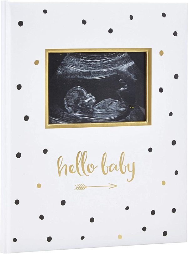 Pear Head Sonogram Baby Memory Book, Black and Gold Polka Dot (72028) - Image 2