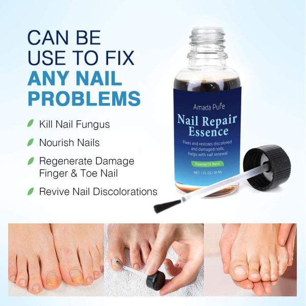 Amada Pure Fungus Stop, Fungus Nail Care Solution ?CToenail & Fingernail Fungus Remover, Restores Discolored & Damaged Nails to a Healthy Appearance, Safe (30ml)