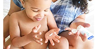 Image of mom putting emollient cream on her toddler.