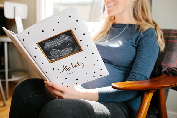 Pear Head Sonogram Baby Memory Book, Black and Gold Polka Dot (72028) - Image 5