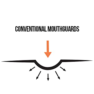 Conventional Mouthguards