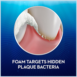Foam targets hidden plaque bacteria