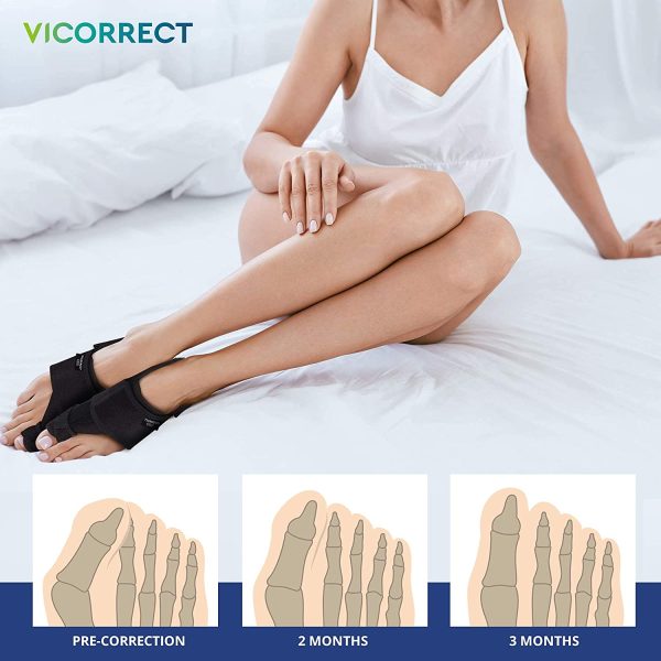 Vicorrect Bunion Corrector & Bunion Toe Separators, Orthopedic Bunion Splint for Big Toe Pain Relief and Toe Straightening, Hallux Valgus Brace for Day/Night Support - Image 5