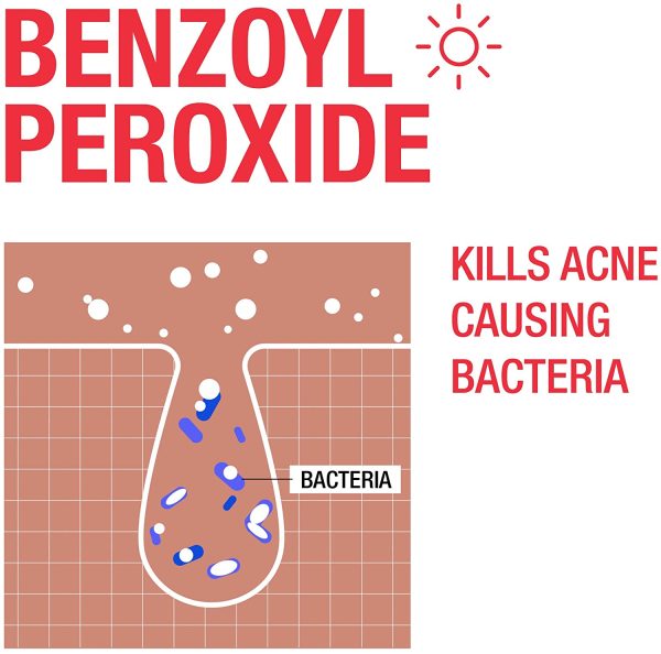 Neutrogena Stubborn AM Acne Treatment - Acne Breakout, Benzoyl Peroxide, Fragrance Free, - Image 2