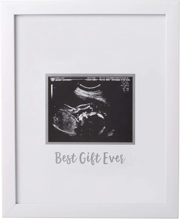 Tiny Ideas Sonogram Signature Frame Guest Book, Perfect for any Baby Registry, Marker Included For Guests to Leave Well-Wishes?M?Great for Celebrating Baby Showers or Birthdays, White - Image 2